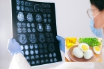 Eggs and Alzheimer’s for health, Eggs and Alzheimer’s breaking, eggs may help prevent alzheimer s study, Eggs