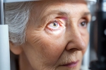 Glaucoma breaking, Glaucoma health experts, all about the eye disease glaucoma, Symptoms