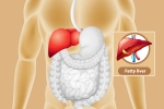 Fatty Liver problems, Fatty Liver suggestions, dangers of fatty liver, V rating
