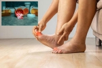 Gout Drugs updates, Gout Drugs breaking, gout drugs may cut the risk of heart attack, United states