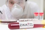 US blood centers, Food and Drug Administration, fda expands zika screening to all us blood centers, Zika virus