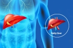 Fatty Liver Disease News health, Fatty Liver Disease News latest, body organs that can be affected by fatty liver disease, Unhealthy eating habits