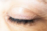 Eyelash Dandruff symptoms, Eyelash Dandruff health, all about eyelash dandruff, Makeup