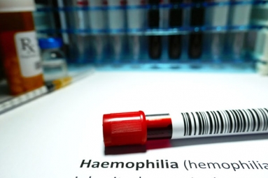 Why are Men Likely to Develop Hemophilia?