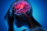 Canada Brain Disease symptoms, Canada Brain Disease news, canada is hit by a mysterious brain disease, Canada brain disease